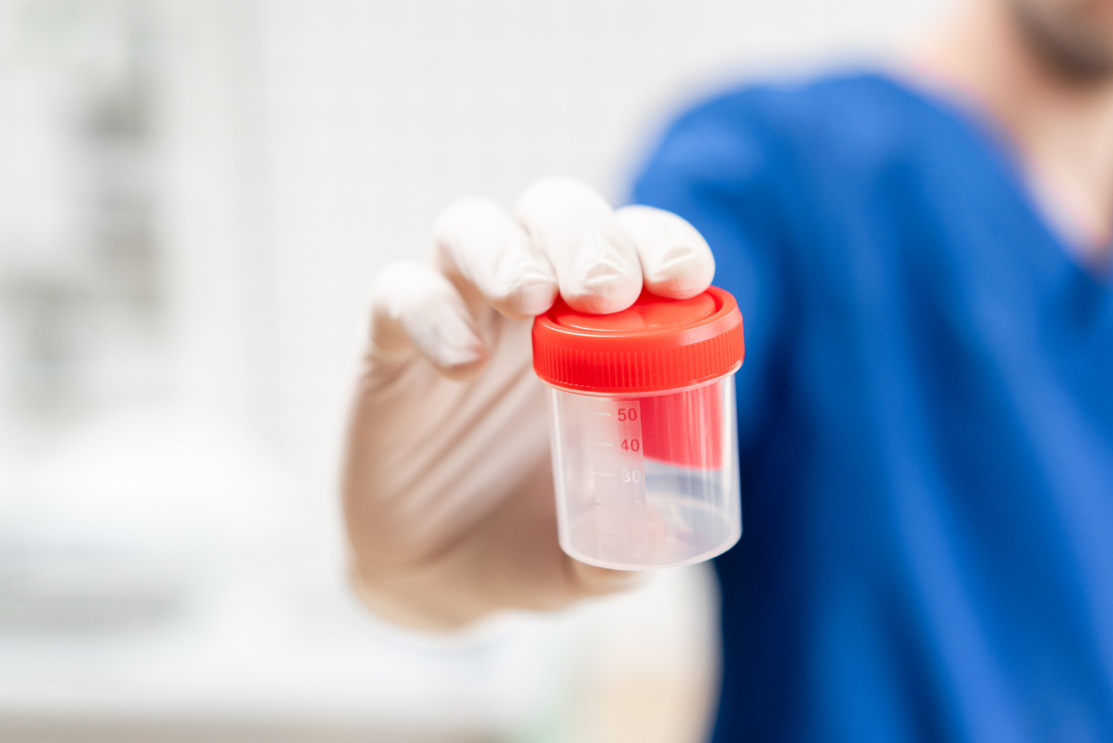 Choosing the Right Saliva Drug Test Kit for Your Business Needs