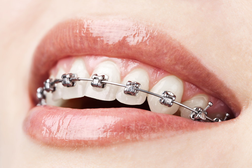 Impact Of Orthodontic Tracing In Business